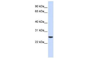 Western Blotting (WB) image for anti-Ubiquitin-Conjugating Enzyme E2K (UBE2K) antibody (ABIN2460006) (UBE2K antibody)