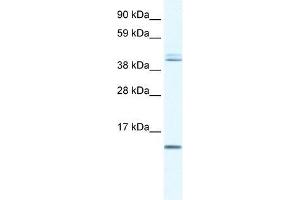 Human Liver; WB Suggested Anti-TSFM Antibody Titration: 0. (TSFM antibody  (N-Term))
