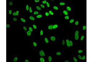 Immunofluorescence staining of Hela cells with ABIN7139612 at 1:15, counter-stained with DAPI. (HIST1H1C antibody  (meLys96))