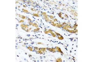 Immunohistochemistry of paraffin-embedded human stomach using OGN antibody (ABIN5975049) at dilution of 1/100 (40x lens). (OGN antibody)