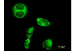 Immunofluorescence of purified MaxPab antibody to SRGAP1 on HeLa cell. (SRGAP1 antibody  (AA 1-1085))