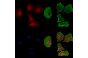 Phospho-SGK1 (Ser78) Antibody staining HepG2 cells(serum starvation treatment) by IF/ICC.