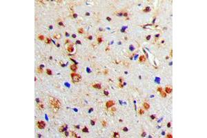 Immunohistochemical analysis of Tyrosine Hydroxylase (pS71) staining in human brain formalin fixed paraffin embedded tissue section. (Tyrosine Hydroxylase antibody  (N-Term, pSer71))