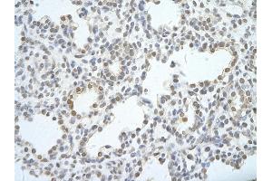 Rabbit Anti-UTP18 antibody Catalog Number: ARP40821  Paraffin Embedded Tissue: Human Lung cell Cellular Data: alveolar cell of renal tubule Antibody Concentration: 4. (UTP18 antibody  (N-Term))