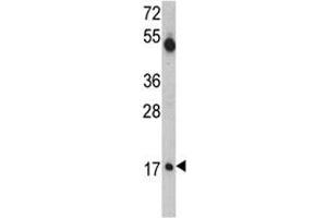 Western blot analysis of UBE2V1 antibody and mouse cerebellum tissue lysate. (UBE2V1 antibody  (AA 113-145))