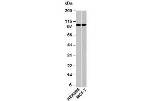 Western blot testing of human samples with LSD1 / KDM1 antibody at 0.
