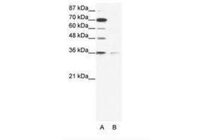 Image no. 1 for anti-Zinc Finger Protein 326 (ZNF326) (AA 469-518) antibody (ABIN203092) (ZNF326 antibody  (AA 469-518))