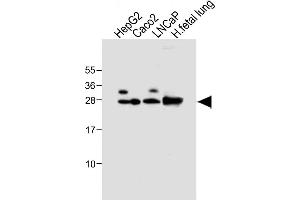 All lanes : Anti-GSTA1 Antibody at 1:4000 dilution Lane 1: HepG2 whole cell lysate Lane 2: Caco2 whole cell lysate Lane 3: LNCaP whole cell lysate Lane 4: Human fetal lung tissue lysate Lysates/proteins at 20 μg per lane.