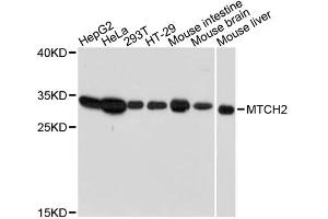 Western blot analysis of extracts of various cell lines, using MTCH2 antibody. (MTCH2 antibody)