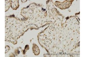 Image no. 1 for anti-Mitogen-Activated Protein Kinase-Activated Protein Kinase 3 (MAPKAPK3) (AA 272-382) antibody (ABIN599019) (MAPKAP Kinase 3 antibody  (AA 272-382))