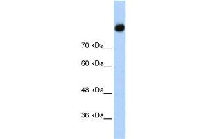 WB Suggested Anti-C2 Antibody Titration:  1. (Complement C2 antibody  (Middle Region))