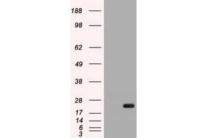 Image no. 2 for anti-Interleukin 6 (IL6) (AA 29-212) antibody (ABIN1491343) (IL-6 antibody  (AA 29-212))