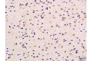 Formalin-fixed and paraffin embedded rat brain labeled with Anti-Neurotrophin 4/NT-4/NT-5 Polyclonal Antibody, Unconjugated (ABIN725615) at 1:200 followed by conjugation to the secondary antibody and DAB staining (Neurotrophin 4 antibody  (AA 121-210))