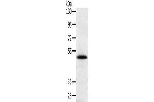 Western Blotting (WB) image for anti-SPARC Related Modular Calcium Binding 2 (SMOC2) antibody (ABIN2433891) (SMOC2 antibody)