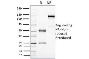 SDS-PAGE Analysis Purified HER-4 / ERBB4 Mouse Monoclonal Antibody (HFR-1). (ERBB4 antibody  (AA 1116-1269))