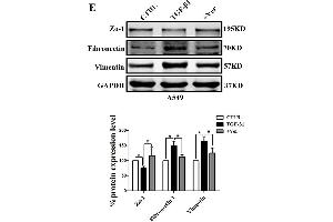Inhibiting the co-transcription complex YAP/TEAD reverses A549 cell proliferation, migration, and invasion induced by TGF-β1. (GAPDH antibody)