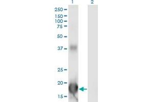 Western Blot analysis of ID4 expression in transfected 293T cell line by ID4 monoclonal antibody (M13), clone 3F11. (ID4 antibody  (AA 1-161))