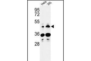 HS3ST2 anticorps  (C-Term)