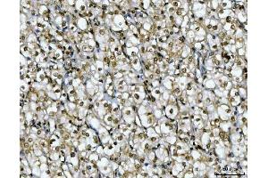 IHC analysis of Ki67/MKI67 using anti-Ki67/MKI67 antibody (ABIN7601873).