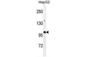 GPAM Antibody (Center) western blot analysis in HepG2 cell line lysates (35µg/lane). (GPAM antibody  (Middle Region))