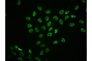 Immunofluorescence staining of Hela cells with ABIN7127707 at 1:100,counter-stained with DAPI. (Recombinant ERK1 antibody  (pThr185, pThr202))