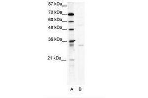 Image no. 1 for anti-TRIM17 / RNF16 (TRIM17) (AA 381-430) antibody (ABIN203174) (TRIM17 / RNF16 antibody  (AA 381-430))
