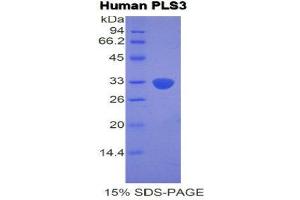 SDS-PAGE (SDS) image for Plastin 3 (PLS3) (AA 379-630) protein (His tag) (ABIN2121905)