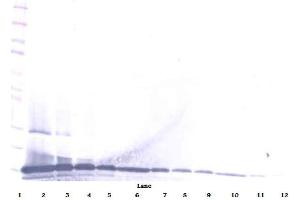 Western Blot (Reduced) using MEC / CCL28 antibody (CCL28 antibody)