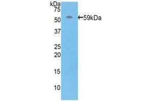 Detection of Recombinant PRF1, Human using Polyclonal Antibody to Perforin 1 (PRF1) (Perforin 1 antibody  (AA 32-316))
