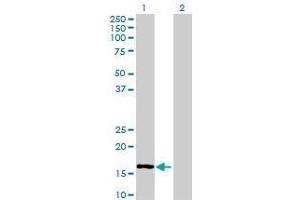 Lane 1: MRPL50 transfected lysate ( 18.
