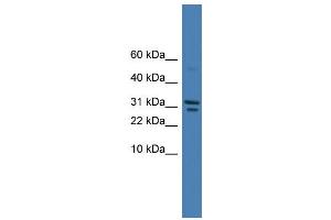 WB Suggested Anti-SPINT2 Antibody Titration: 0.