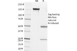 SDS-PAGE Analysis Purified pS2 Mouse Monoclonal Antibody (GE2). (TFF1 antibody  (AA 57-84))