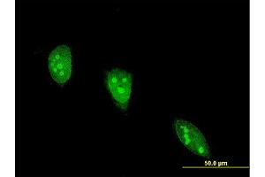 Immunofluorescence of monoclonal antibody to ANGPTL7 on HeLa cell. (ANGPTL7 antibody  (AA 27-126))