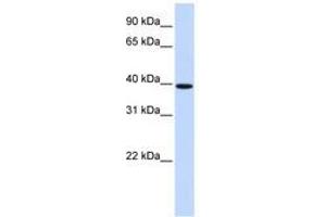 Image no. 1 for anti-Homeobox B3 (HOXB3) (AA 72-121) antibody (ABIN6741414) (HOXB3 antibody  (AA 72-121))