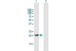 Western Blot analysis of GM2A expression in transfected 293T cell line by GM2A MaxPab polyclonal antibody. (GM2A antibody  (AA 1-193))