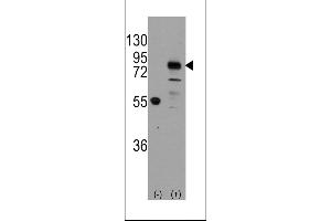 Western blot analysis of CDH9 using rabbit polyclonal CDH9 Antibody using 293 cell lysates (2 ug/lane) either nontransfected (Lane 1) or transiently transfected with the CDH9 gene (Lane 2). (Cadherin 9 antibody  (C-Term))