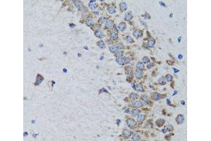 Immunohistochemistry of paraffin-embedded Rat brain using PTPN1 Polyclonal Antibody at dilution of 1:100 (40x lens).