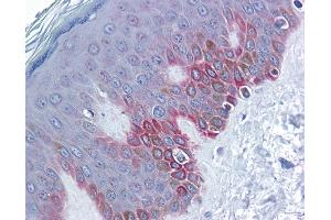 Immunohistochemistry (IHC) image for anti-Frizzled Family Receptor 5 (FZD5) (Middle Region) antibody (ABIN2776705) (FZD5 antibody  (Middle Region))