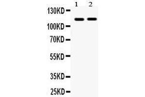 Observed bind size: 114KD (EPH Receptor A5 antibody  (C-Term))