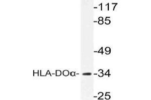 Western blot (WB) analysis of HLA-DOalpha antibody in extracts from COLO cells. (HLA-DOA antibody)