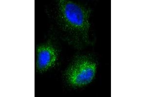 Immunofluorescent analysis of 4 % paraformaldehyde-fixed, 0. (Surfactant Protein C antibody  (N-Term))