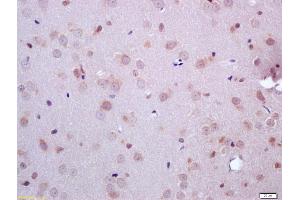 Formalin-fixed and paraffin embedded rat brain labeled with Anti-ARHI Polyclonal Antibody, Unconjugated (ABIN681448) at 1:200 followed by conjugation to the secondary antibody and DAB staining (DIRAS3 antibody  (AA 131-229))