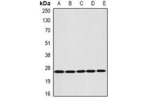 Western blot analysis of DIRAS3 expression in NIH3T3 (A), mouse liver (B), mouse brain (C), rat liver (D), rat kidney (E) whole cell lysates. (DIRAS3 antibody)
