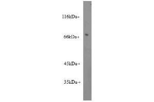 Western blot analysis of human hear tissue subjected to SDS-PAGE, using GAA antibody (1/600 dilution, incubated at room temperature for 1. (GAA antibody)