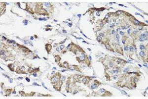 Immunohistochemistry of paraffin-embedded Human stomach using WASF3 Polyclonal Antibody at dilution of 1:100 (40x lens). (WASF3 antibody)