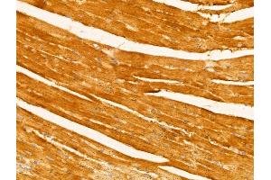 ABIN6263218 and ABIN6273007 at 1/100 staining Mouse heart tissue by IHC-P. (Melanophilin antibody  (C-Term))