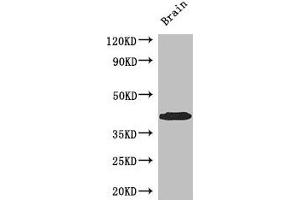 Western Blot Positive WB detected in: Mouse brain tissue All lanes: SPDEF antibody at 3 μg/mL Secondary Goat polyclonal to rabbit IgG at 1/50000 dilution Predicted band size: 38, 36 kDa Observed band size: 38 kDa