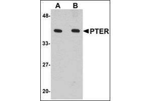 Western blot analysis of PTER in human kidney tissue lysate with this product at (A) 1 and (B) 2 μg/ml. (PTER antibody  (C-Term))