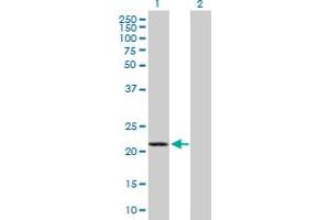 Western Blot analysis of GCET2 expression in transfected 293T cell line by GCET2 MaxPab polyclonal antibody. (GCET2 antibody  (AA 1-178))