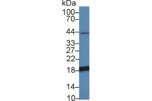 Detection of NME3 in Mouse Heart lysate using Polyclonal Antibody to Non Metastatic Cells 3, Protein NM23A Expressed In (NME3) (NME3 antibody  (AA 1-168))